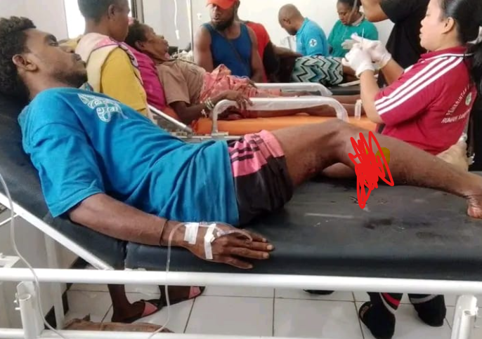 Tiga Warga Sipil Korban Penembakan di Muara Aifat, Sementara Jalani Perawatan Di Rumah Sakit Sunere Maybrat
